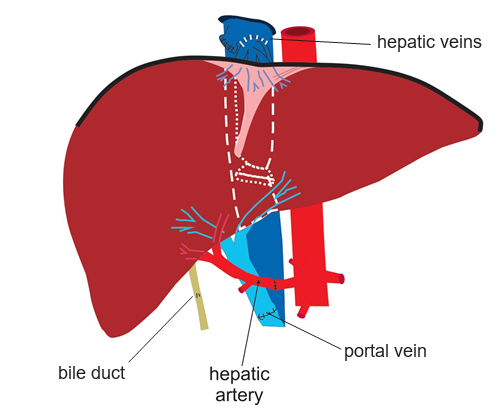 The “Piggy Back” technique for sewing the new liver in